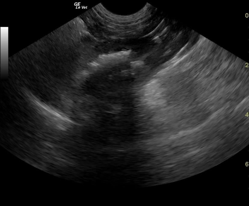 Portoazygos shunt with renal and bladder calculi in a 4 year old F ...