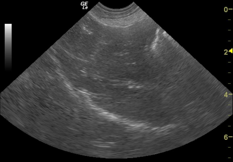 Microhepatica with Vacuolar Hepatopathy in a 5 year old MN Shih Tzu dog ...