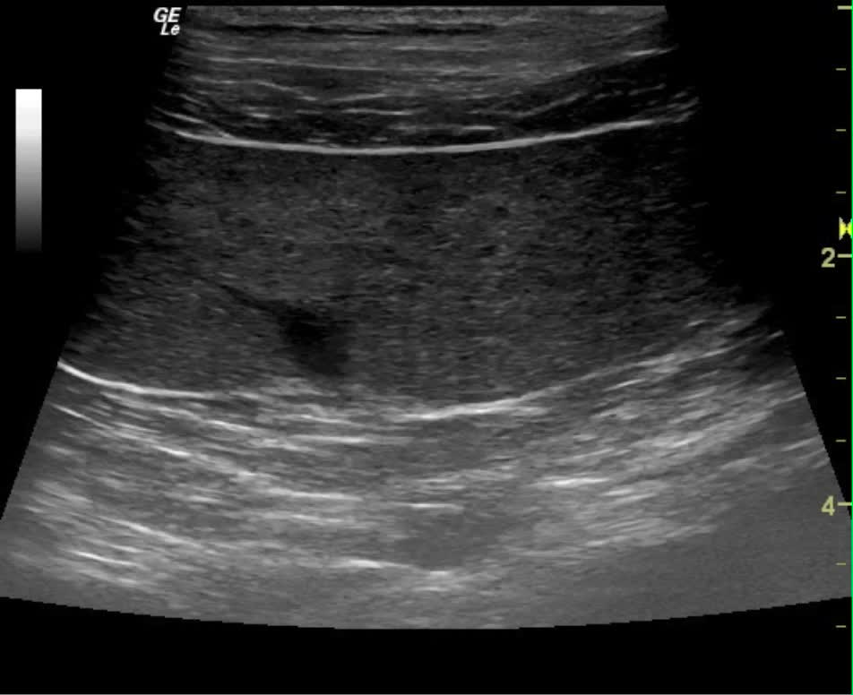 Lymphoma in a 4 year old FS Labrador Retriever mix dog Members