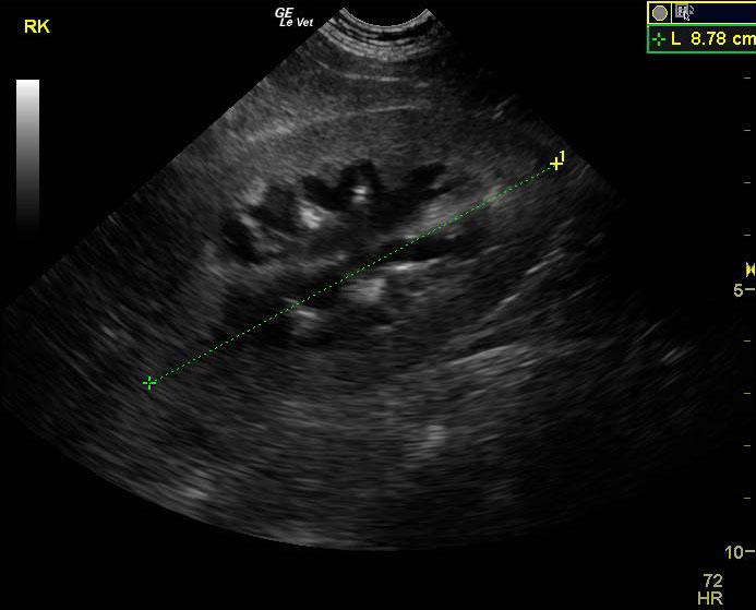 06-00069 Cody R TCC of prostate and urethra. Bilat hydronephrosis-NEEDS ...