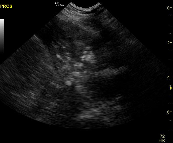 06-00069 Cody R TCC of prostate and urethra. Bilat hydronephrosis-NEEDS ...