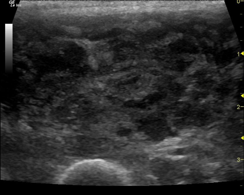 Sarcoma Of The Medial Aspect Of The Forelimb And Regional 