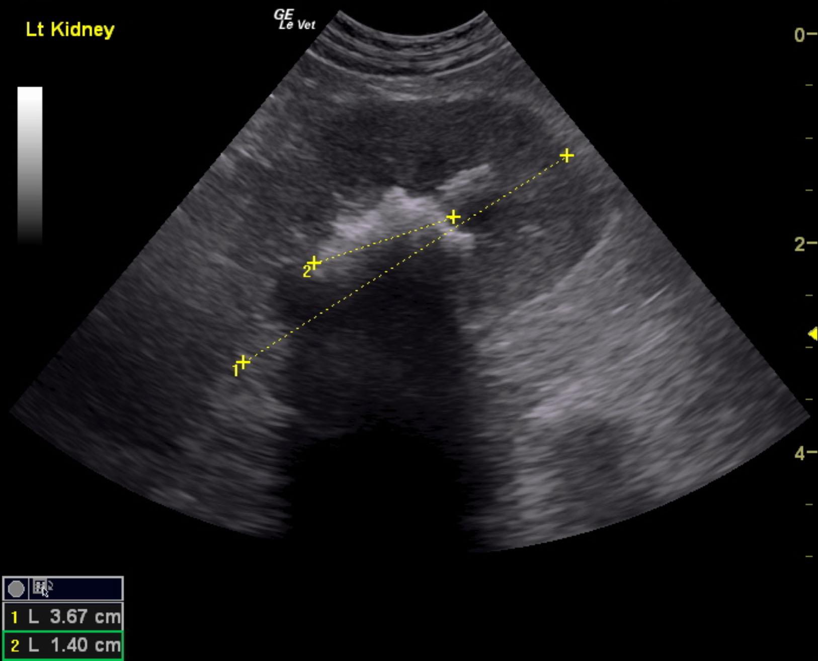 Obstructive urolithiasis, pyelonephritis, nephritis, and bladder stones ...