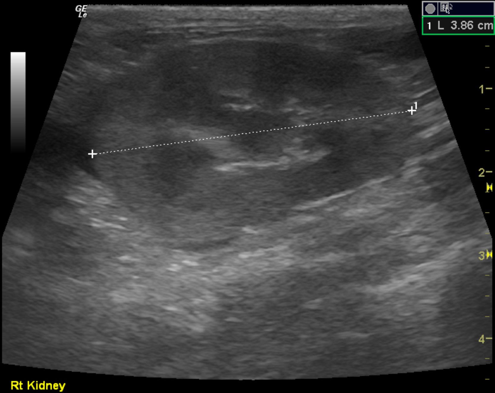 Renal lymphoma in a 14 year old FS DSH cat - Members