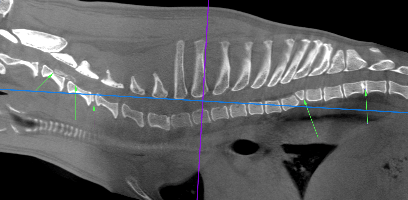 CT Degenerative Joint Disease of the Stifle and Vertebral Malformation