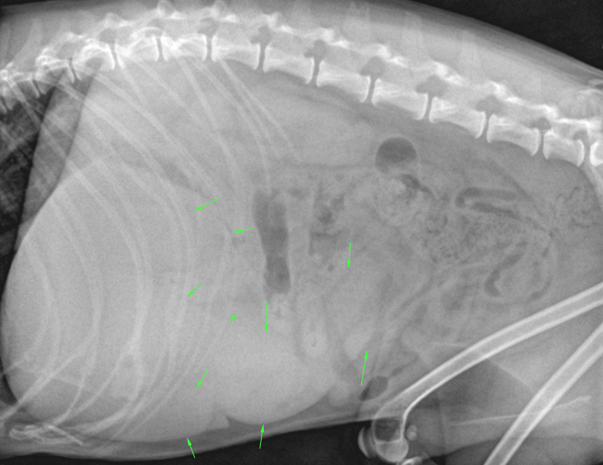 RADS - Multiple Myeloma/Plasmocytoma in an 8 year old MN Chinese ...