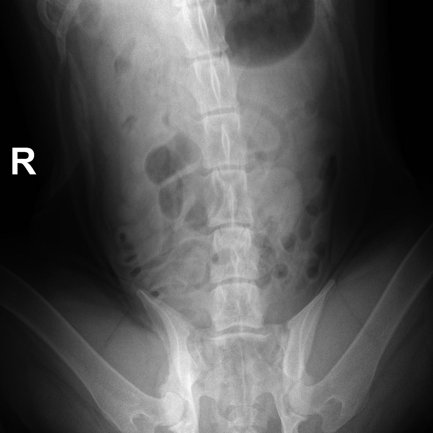 Normal Thorax Rads In Dogs RAD - normal abdomen and caudal thorax in a 3 year old M St. Bernard ...