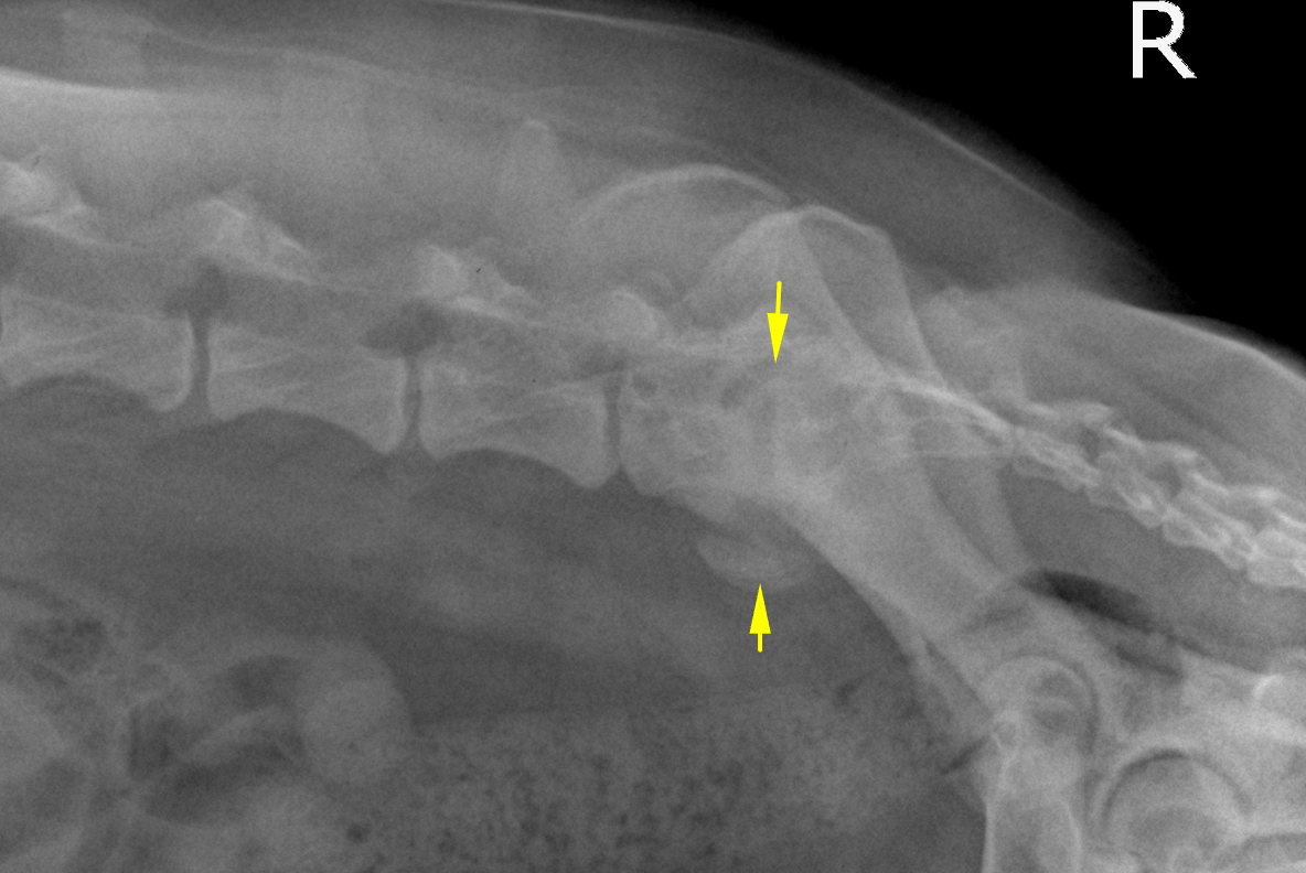 RAD - chronic degenerative lumbosacral stenosis in a 5 year old MN ...