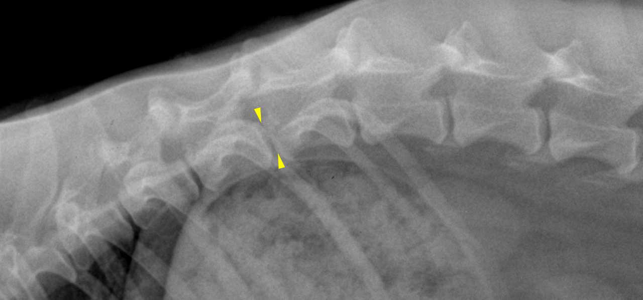 RAD - chronic degenerative lumbosacral stenosis in a 5 year old MN ...