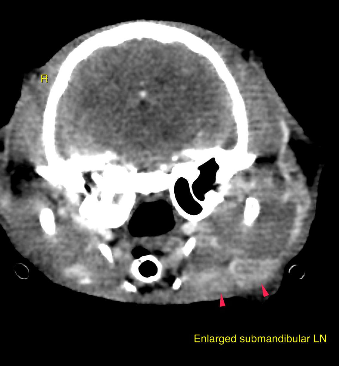 CT - Primary soft tissue neoplasia in the buccal/labial region with ...