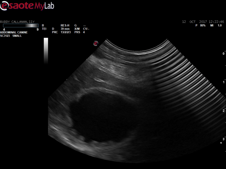 common bile duct obstruction