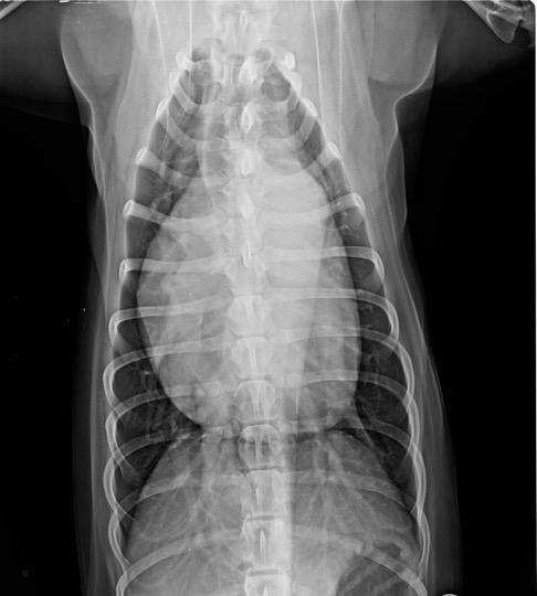 PDA, Valvular Aortic Stenosis, Valvular Pulmonic Stenosis and Mitral ...