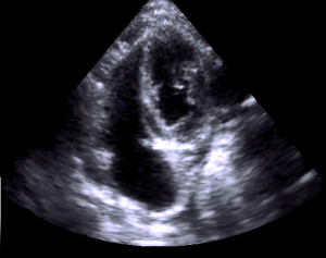 Cat restrictive cardiomyopathy (RCM)? non classified ? - Members