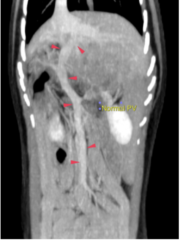 CT- structurally normal abdomen in a 3 year old FS Yorkshire Terrier ...